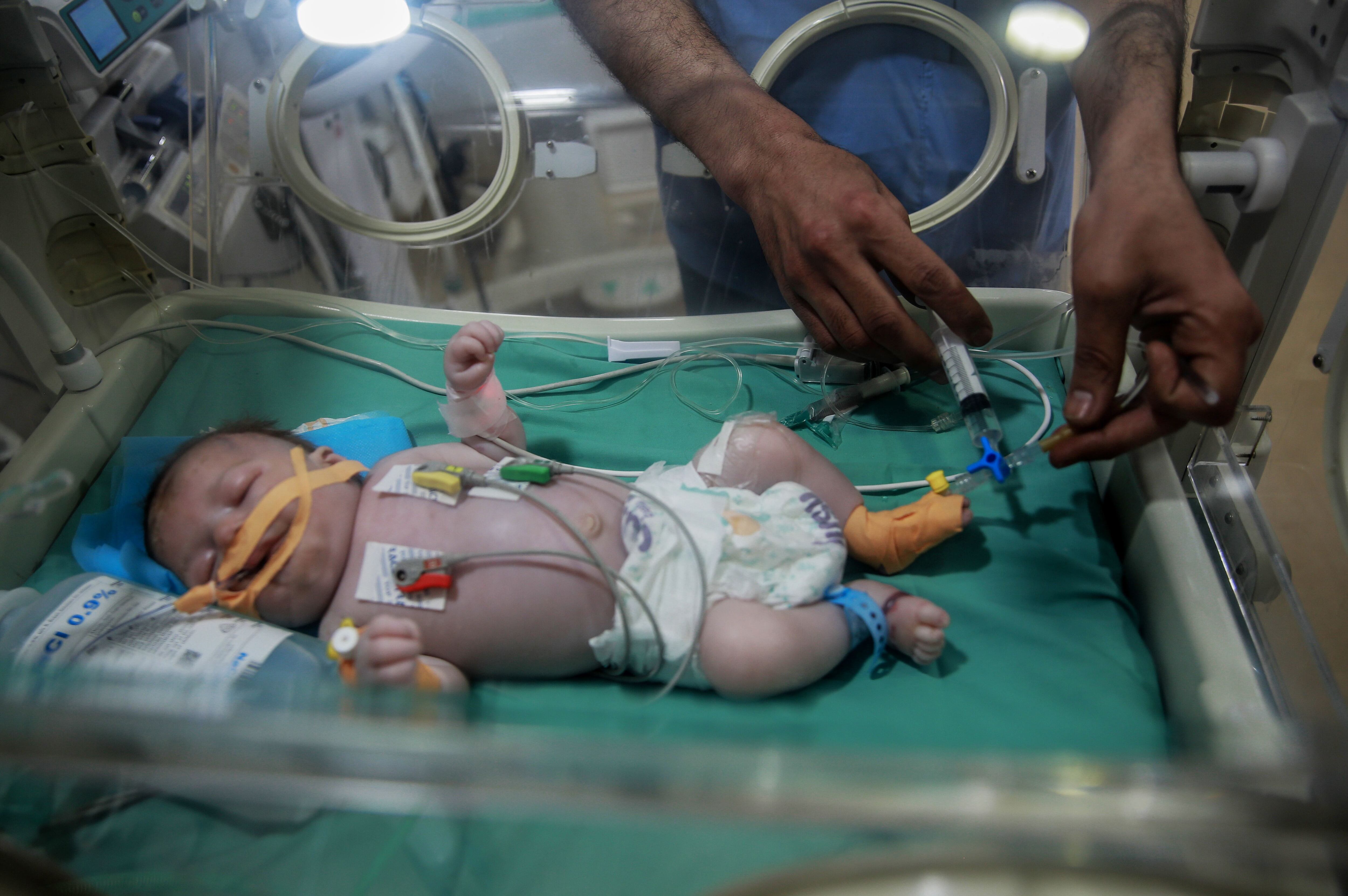A baby is looked after at the neonatal unit at Kamal Adhwan hospital in Beit Lahia in the Gaza Strip, where children are born with complications due to malnourished mothers.